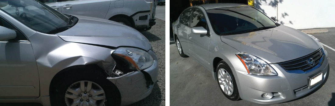 Before and After Photos 03