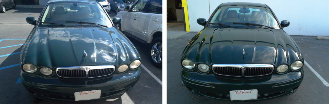 Before and After Photos 07