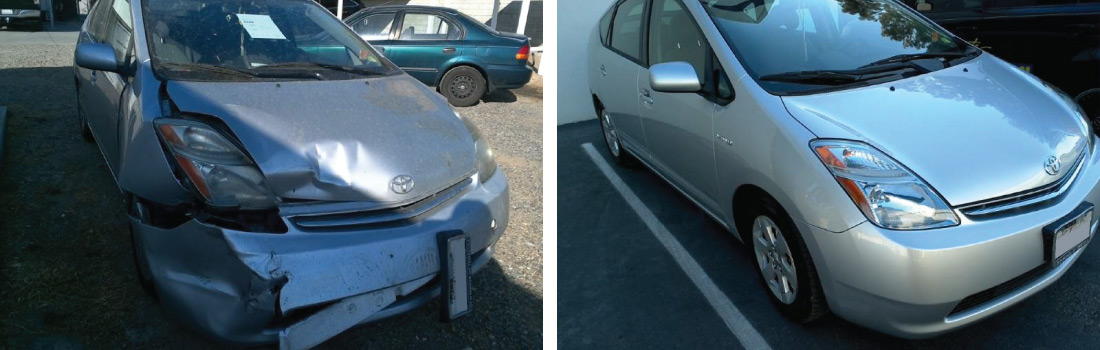 Before and After Photos 08